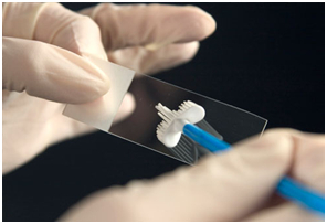 Il pap test per l'infezione papillomavirus umano